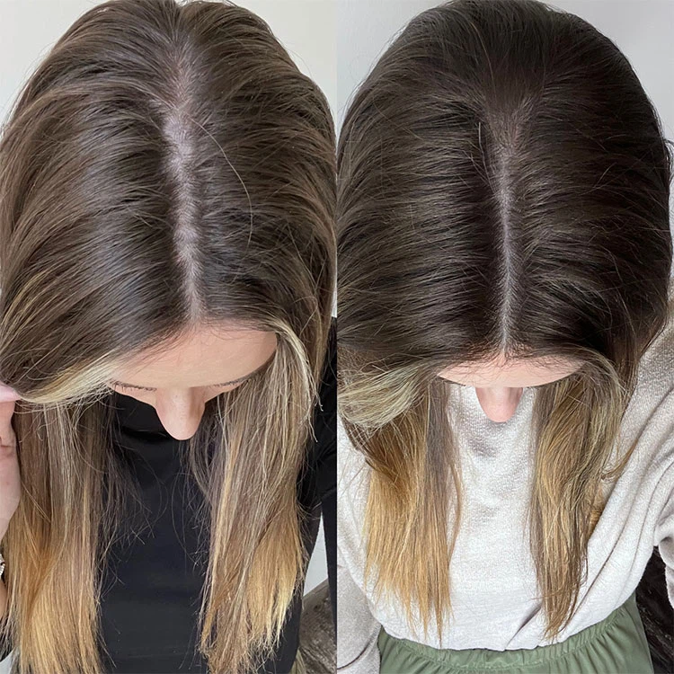 BEFORE AND AFTER BEFORE AND AFTER